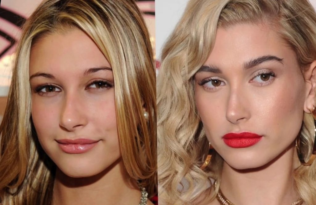 Hailey Baldwin's eyes pictured then and now| Image: YouTube/ Lorry Hill
