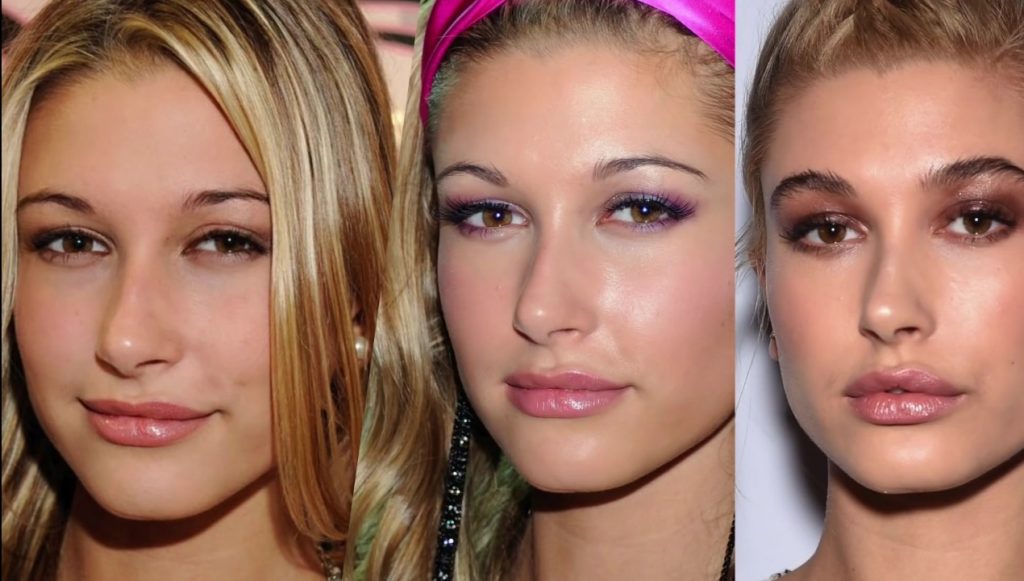 Hailey Baldwin's lips pictured at different stages | Image: YouTube/ Lorry Hill