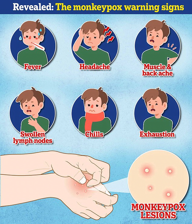 A chart showing the various symptoms of monkeypox | Imahe: Pinterest