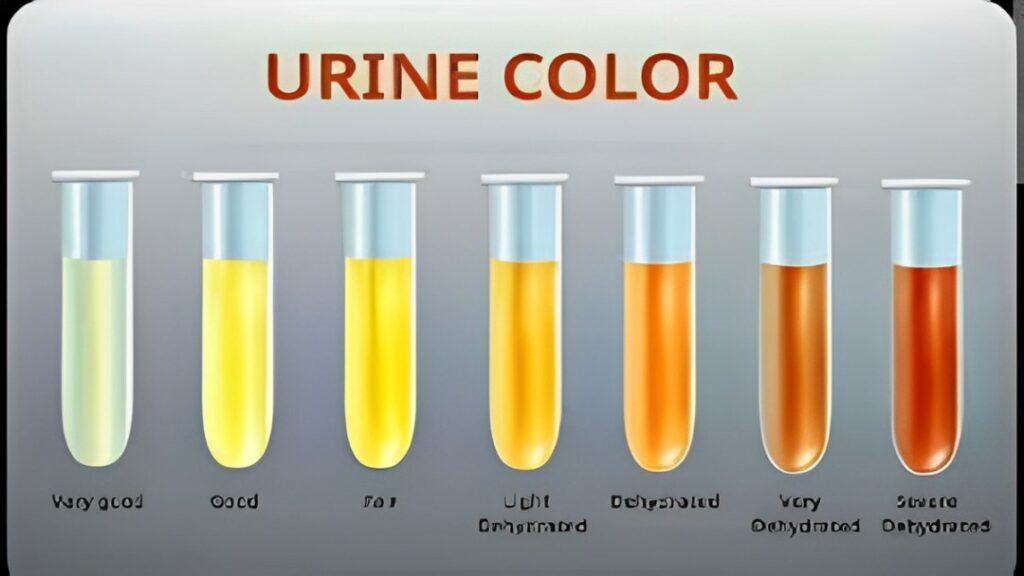 Clear Urine Color