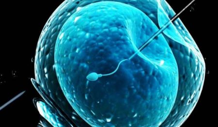 In-vitro fertilization