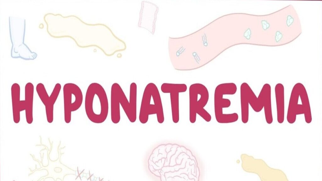 Understanding Hyponatre